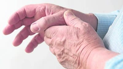 Las Purinas y el Ácido Úrico