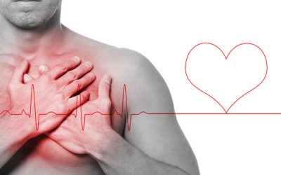 Recomendaciones para prevenir las Enfermedades Cardiovasculares